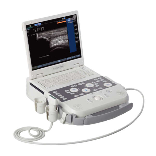 Acuson-P300-Ultrasound-System