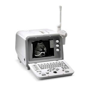 DRE-FS-32P-Digital-Ultrasound-Machine