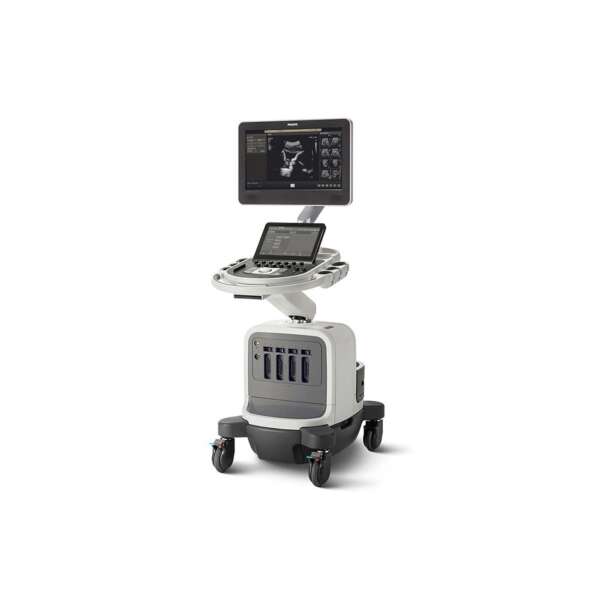 Philips Affiniti 70 Ultrasound System