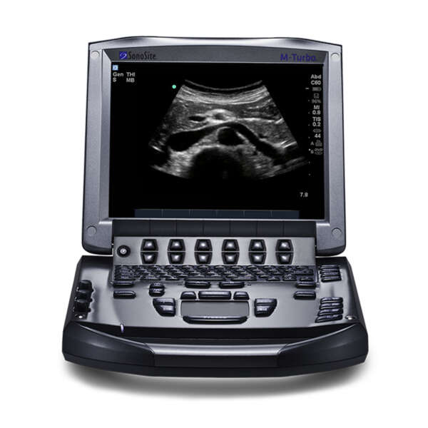 Sonosite-M-Turbo-Ultrasound-System